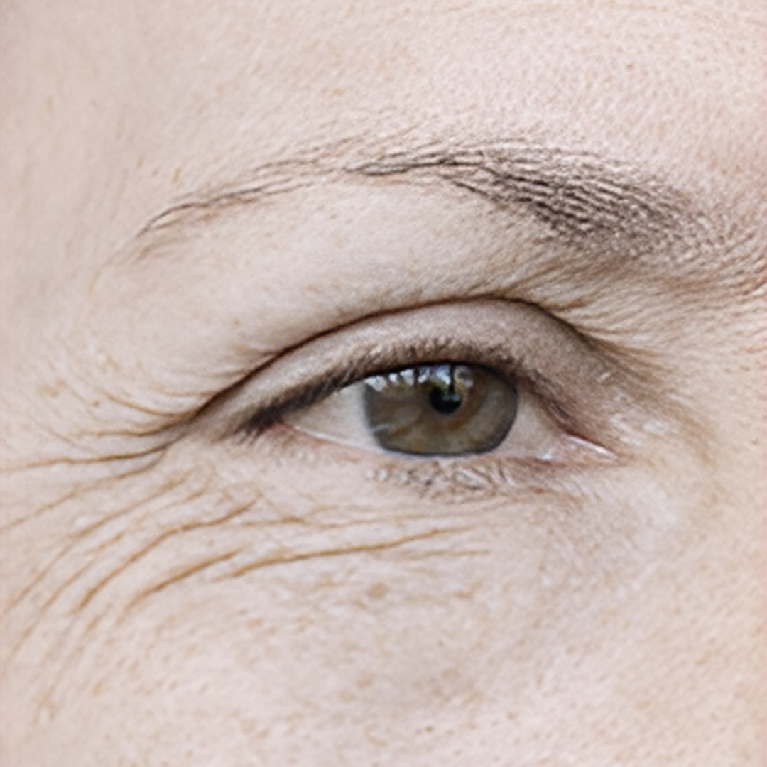 image comparison before