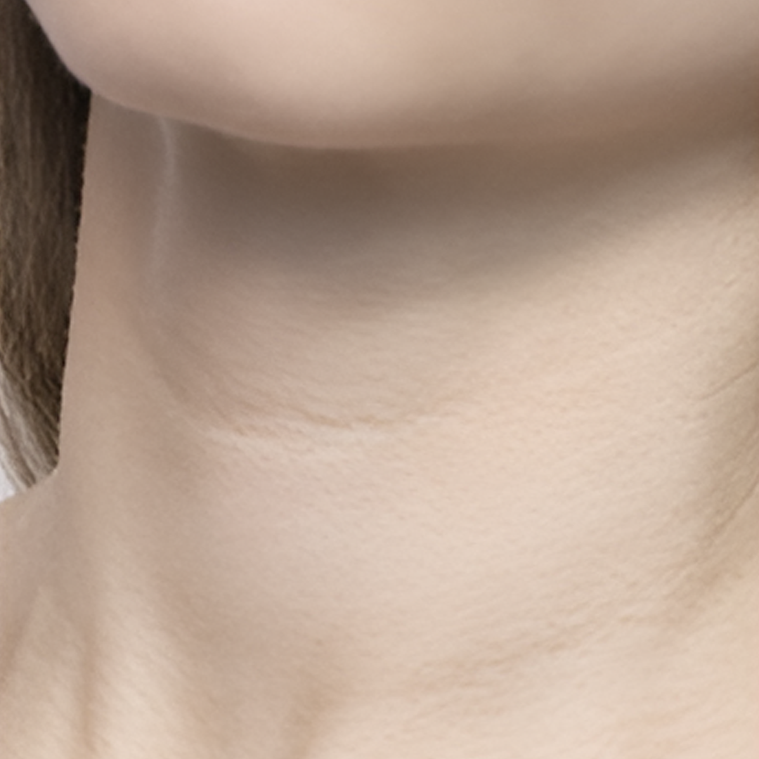 image comparison before